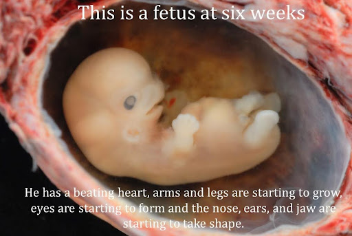 Image of a six week old fetus